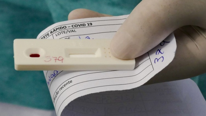Estudo aponta que assintomáticos perdem anticorpos da Covid-19 mais rapidamente