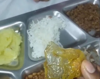 Saco plástico é encontrado em refeição servida a criança no Hospital Antônio Ferraz, em Macau, RN.