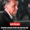Carlos posta foto de perna de Bolsonaro com erisipela.