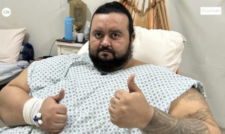 Após perder quase 50 quilos, cirurgia bariátrica de Renan Mesquista